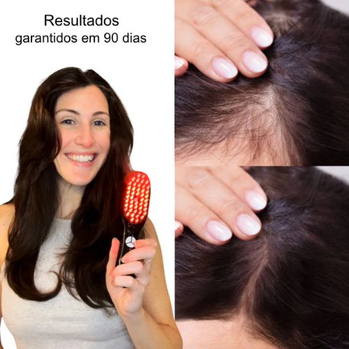 Terapia Capilar, Escova Modeladora, Escova Anti Queda