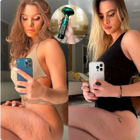 Massageador Anti Celulite + Brinde Óleo de Massagem